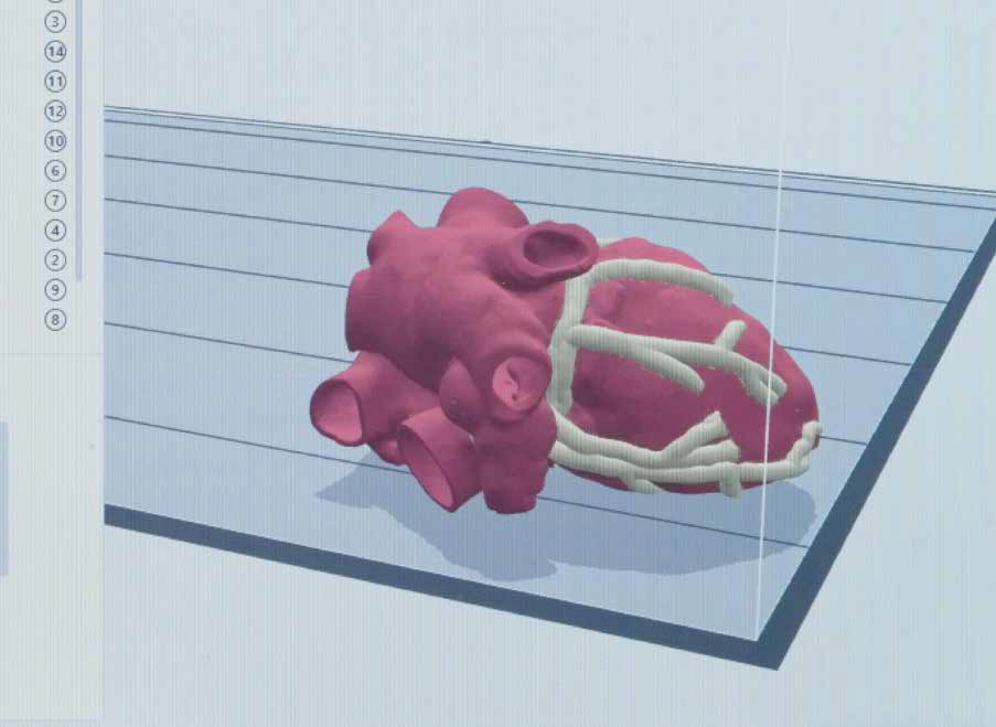 西京醫(yī)院使用J850降低心臟手術風險